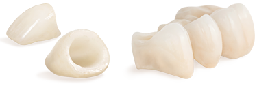 Dental Crowns & Bridge Albuquerque