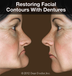 Removable Dentures in Albuquerque