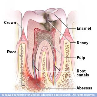 Root Canal Treatment in Albuquerque