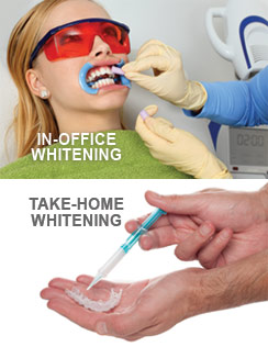 Teeth Whitening Albuquerque