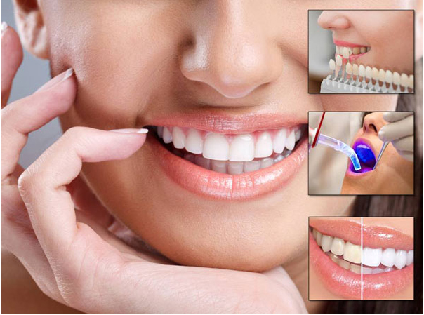 What are the Treatments in Cosmetic Dentistry